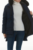 Deep Blue Casual Solid Patchwork Hooded Collar Outerwear