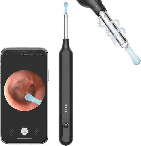 1080P Ear Wax Removal Camera - Clear Visuals for Safe and Effective Cleaning