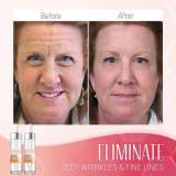 Last Day Promotion 49% OFFAnti-Aging Serum