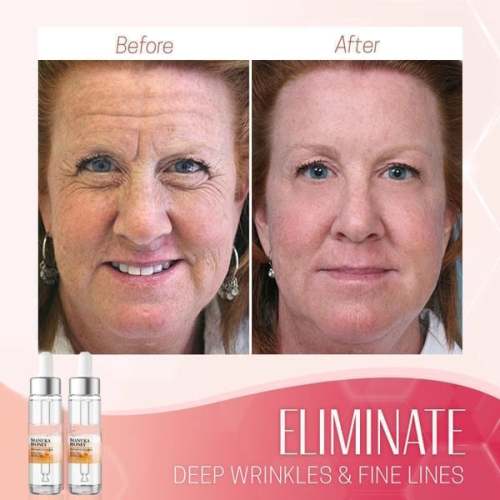 Last Day Promotion 49% OFFAnti-Aging Serum