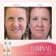 Last Day Promotion 49% OFFAnti-Aging Serum